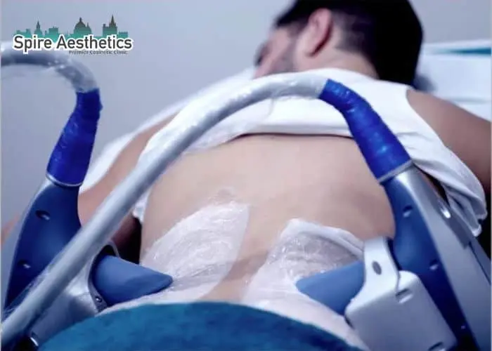 Man having fat freezing treatment done on love handles before a competitions Busby to create a sculpted look.