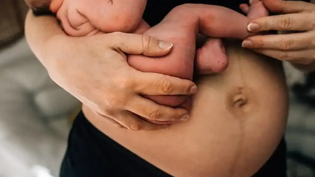 Why Is My Stomach Still Big After Pregnancy Busby?